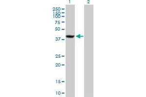 Western Blot analysis of SDCCAG8 expression in transfected 293T cell line by SDCCAG8 MaxPab polyclonal antibody. (SDCCAG8 anticorps  (AA 1-360))