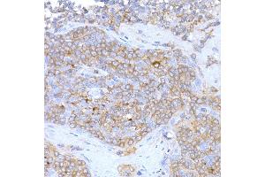 Immunohistochemistry of paraffin-embedded human tonsil using M Rabbit pAb (ABIN3021414, ABIN3021415, ABIN3021416 and ABIN6215021) at dilution of 1:500 (40x lens).