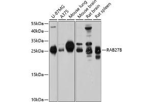 Western blot analysis of extracts of various cell lines, using RB antibody (ABIN6132610, ABIN6146565, ABIN6146566 and ABIN6214629) at 1:1000 dilution. (RAB27B anticorps  (AA 1-218))