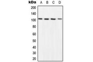 Western blot analysis of NF-kappaB p105 (pS932) expression in HeLa LPS-treated (A), NIH3T3 LPS-treated (B), Raw264. (NFKB1 anticorps  (C-Term, pSer932))