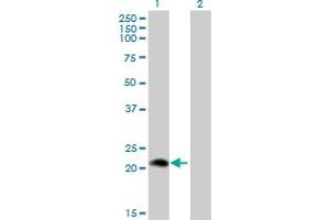 Western Blot analysis of PLA2G12A expression in transfected 293T cell line by PLA2G12A monoclonal antibody (M01), clone 1D11. (PLA2G12A anticorps  (AA 90-188))
