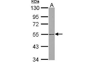 Western Blotting (WB) image for anti-SH3-Domain Binding Protein 5 (SH3BP5) (AA 193-455) antibody (ABIN1500917) (SH3BP5 anticorps  (AA 193-455))