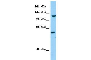 WB Suggested Anti-TLL1 Antibody Titration: 1. (TLL1 anticorps  (C-Term))