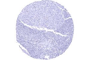 Lymph node with weak to moderate TLE1 staining in a subset of lymphocytes predominantly in germinal centres (Recombinant TLE1 anticorps)