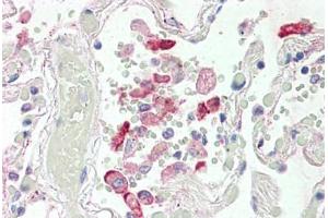 Human Lung (formalin-fixed, paraffin-embedded) stained with CES1 antibody ABIN337128 at 2. (CES1 anticorps  (AA 533-544))