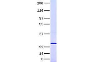 Validation with Western Blot