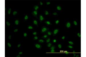 Immunofluorescence of monoclonal antibody to PRKAA1 on HeLa cell. (PRKAA1 anticorps  (AA 451-550))