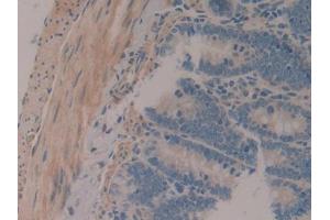 IHC-P analysis of Rat Intestine Tissue, with DAB staining. (MAP1A anticorps  (AA 2110-2367))