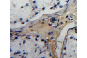 Used in DAB staining on fromalin fixed paraffin-embedded testis tissue