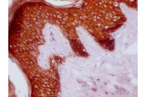 IHC image of ABIN7180977 diluted at 1:100 and staining in paraffin-embedded human skin tissue performed on a Leica BondTM system. (KRT14 anticorps)