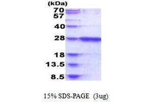 SDS-PAGE (SDS) image for RAB39B, Member RAS Oncogene Family (RAB39B) (AA 1-213) protein (His tag) (ABIN5853890)
