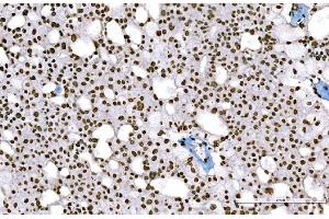 IHC analysis of Histone H1. (Histone H1 anticorps  (AA 20-159))