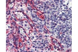 IHC Analysis: Human spleen tissue stained with Caspase-9, mAb (2-22) at 10 μg/mL. (Caspase 9 anticorps)