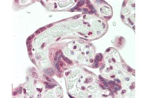 Formalin-fixed and paraffin-embedded H. (HERV (ERVWE1) (AA 400-429) anticorps)