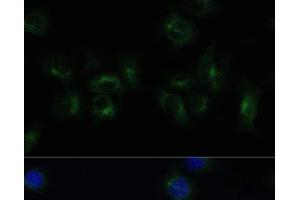 Immunofluorescence analysis of HeLa cells using CLTB Polyclonal Antibody at dilution of 1:100 (40x lens).