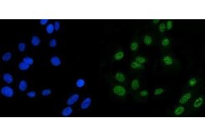 IF analysis of MSH6 using anti-MSH6 antibody (ABIN7601449).