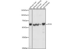 Western blot analysis of extracts of various cell lines, using PCK1 antibody (ABIN3022753, ABIN3022754, ABIN3022755 and ABIN6219210) at 1:1000 dilution. (PCK1 anticorps  (C-Term))