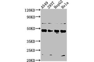 Western Blot Positive WB detected in: A549 whole cell lysate, 293T whole cell lysate, HepG2 whole cell lysate, Hela whole cell lysate All lanes: SNX5 antibody at 1:2000 Secondary Goat polyclonal to rabbit IgG at 1/50000 dilution Predicted band size: 47, 14 kDa Observed band size: 47 kDa (SNX5 anticorps  (AA 7-245))