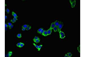 Immunofluorescent analysis of HepG2 cells using ABIN7144390 at dilution of 1:100 and Alexa Fluor 488-congugated AffiniPure Goat Anti-Rabbit IgG(H+L)