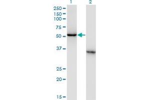 Western Blot analysis of NXF3 expression in transfected 293T cell line by NXF3 monoclonal antibody (M02), clone 2C7. (NXF3 anticorps  (AA 1-100))