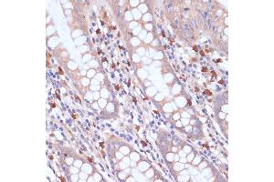 Immunohistochemistry of paraffin-embedded human colon using PI3 Kinase p85 beta antibody (ABIN7269320) at dilution of 1:200 (40x lens).