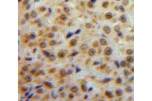 Used in DAB staining on fromalin fixed paraffin-embedded Ovary tissue (ESR2 anticorps  (AA 149-213))