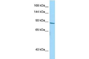 Western Blotting (WB) image for anti-Neuroblastoma Breakpoint Family, Member 10 (NBPF10) (C-Term) antibody (ABIN2790662)