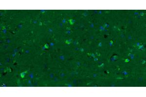 Paraformaldehyde-fixed, paraffin embedded Human glioma, Antigen retrieval by boiling in sodium citrate buffer (pH6.