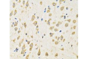 Immunohistochemistry of paraffin-embedded Mouse brain using PTPRE Polyclonal Antibody at dilution of 1:100 (40x lens).