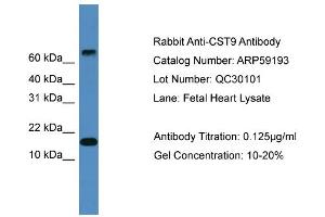 WB Suggested Anti-CST9  Antibody Titration: 0. (CST9 anticorps  (Middle Region))