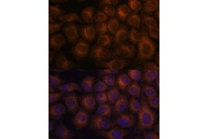 Immunofluorescence analysis of HeLa cells using V antibody  at dilution of 1:100.