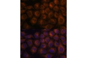 Immunofluorescence analysis of HeLa cells using V antibody  at dilution of 1:100. (VAV3 anticorps  (AA 560-680))