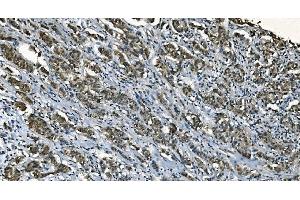 IHC analysis of CDC45L using anti-CDC45L antibody (ABIN7600230). (CDC45 anticorps  (AA 166-431))