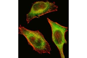 Fluorescent image of Hela cell stained with TEC Antibody (Center) (ABIN392111 and ABIN2841862). (NR4A3 anticorps  (AA 175-205))
