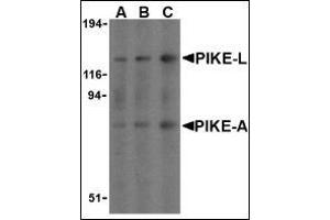 Western blot analysis of PIKE in mouse brain cell lysates with this product at (A) 0. (AGAP2 anticorps  (C-Term))
