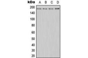Western blot analysis of MERTK expression in Jurkat (A), HeLa (B), Raw264. (MERTK anticorps  (N-Term))