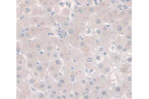 DAB staining on IHC-P;Samples:Human Liver Tissue. (CD73 anticorps  (AA 29-500))