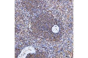 IHC analysis of SMARCA2/BRM using anti-SMARCA2/BRM antibody (ABIN7601969).