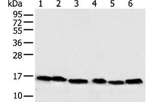 Western blot analysis of 293T Hela PC-3 Lncap and 231 cell Human fetal muscle tissue using NDUFB6 Polyclonal Antibody at dilution of 1:500 (NDUFB6 anticorps)