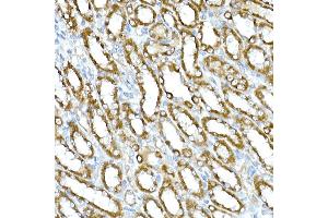 Immunohistochemistry of paraffin-embedded rat kidney using RHOT2 Rabbit pAb (ABIN3016307, ABIN3016308, ABIN1682532 and ABIN6219710) at dilution of 1:50 (40x lens). (RHOT2 anticorps  (AA 280-480))