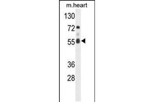 Western blot analysis of hFASTK-R534 in mouse heart tissue lysates (35ug/lane) (FASTK anticorps  (C-Term))