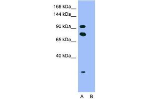 Host:  Rabbit  Target Name:  HIPK2  Sample Type:  HepG2  Lane A:  Primary Antibody  Lane B:  Primary Antibody + Blocking Peptide  Primary Antibody Concentration:  1. (HIPK2 anticorps  (Middle Region))