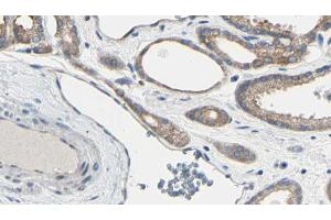 ABIN6267611 at 1/100 staining Human prostate tissue by IHC-P.
