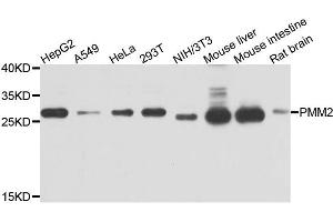 Western blot analysis of extracts of various cells, using PMM2 antibody.
