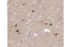 ABIN6267409 at 1/200 staining human brain tissue sections by IHC-P. (JunB anticorps  (pSer259))