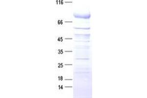 Validation with Western Blot