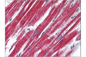 Human Heart (formalin-fixed, paraffin-embedded) stained with LEPRat 4 µg/ml followed by biotinylated anti-goat IgG secondary antibody, alkaline phosphatase-streptavidin and chromogen. (Leptin Receptor anticorps  (Internal Region))
