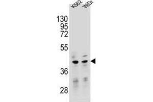 Western Blotting (WB) image for anti-Transcription Factor B2, Mitochondrial (TFB2M) antibody (ABIN2995537) (TFB2M anticorps)