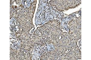 IHC analysis of MCM4 using anti-MCM4 antibody (ABIN7601485).