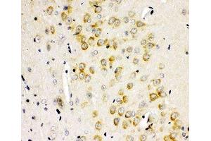 IHC-P: GLUR2 antibody testing of rat brain tissue (GRIA2 anticorps  (AA 25-360))
